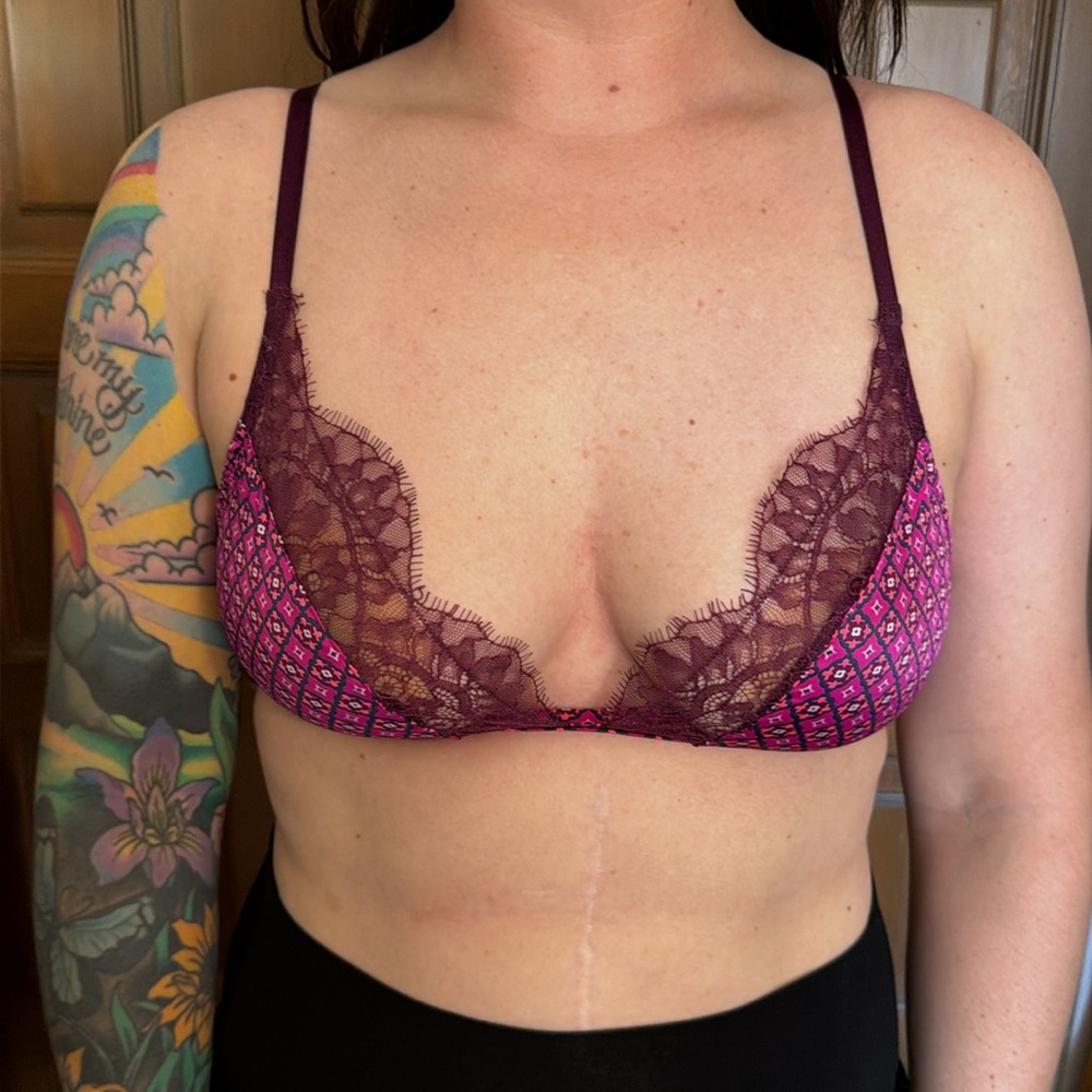 Women's Pink Lace Trim Printed Bralette